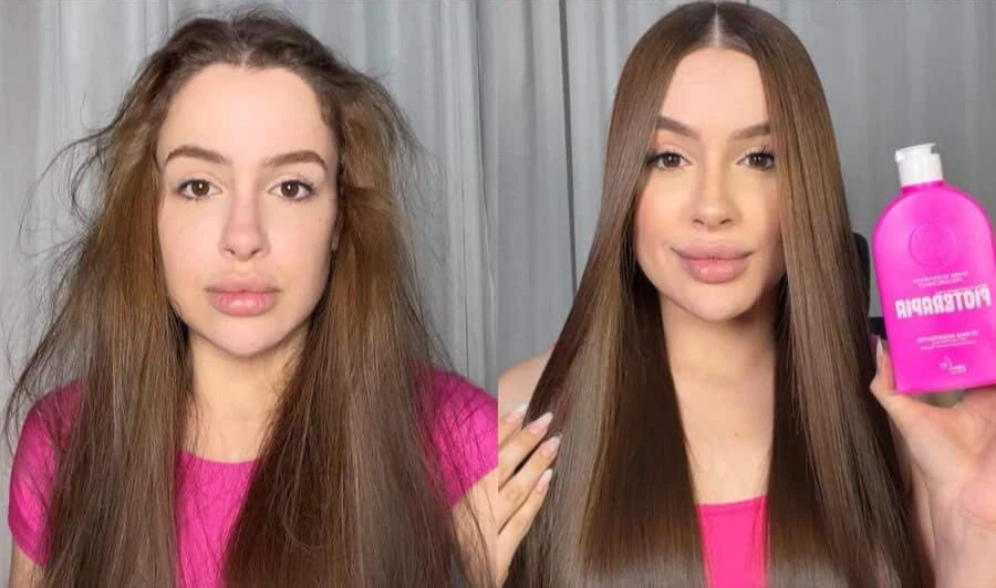Progressiva Fioterapia: Antes e Depois